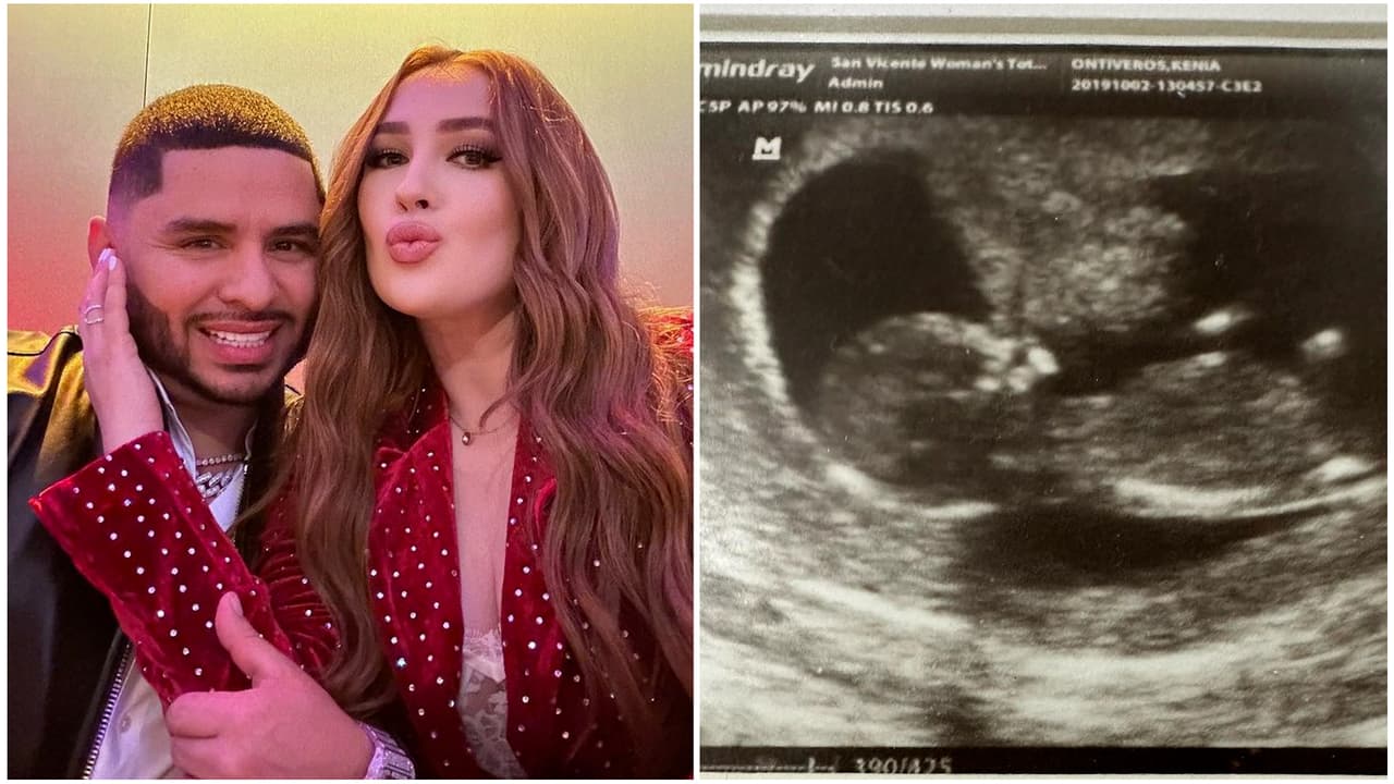 Larry Hernández publicó foto de un ultrasonido y le dicen que "ya valió" el 'mommy makeover' de Kenia