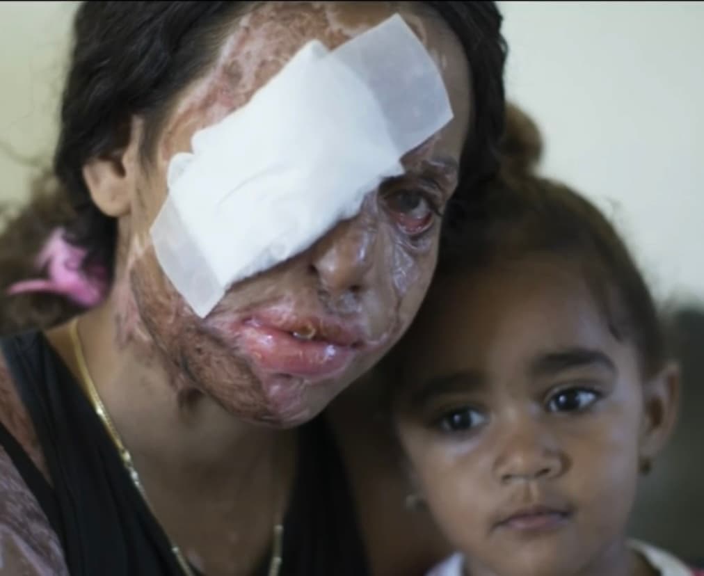 “Les diría a todas las mujeres que no es lo de afuera lo que importa, sino tu corazón y lo que llevas por dentro”, dice la joven que hoy anhela volver a estudiar y trabajar para dejar atrás las heridas físicas y emocionales, 
<b>con la única intención de construirle un futuro a su linda hija. </b>
<br>