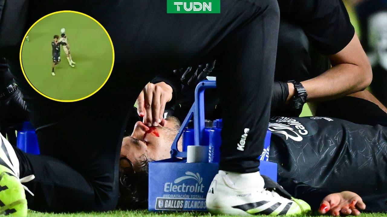 Diego Reyes es mandado al hospital tras fuerte golpe en el Querétaro vs. Santos de Liga MX