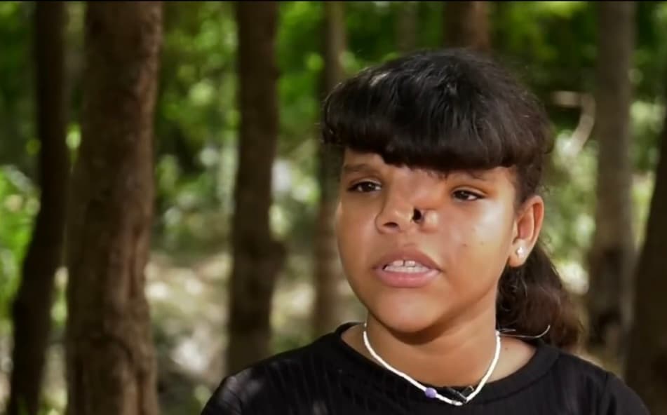 “Me decían sacapuntas y eso me dolía mucho”, dice Luz María, quien decidió no sufrir y encerrarse entre las cuatro paredes de la humilde casa de su familia, donde vive con sus otros cuatro hermanos. 
<br>