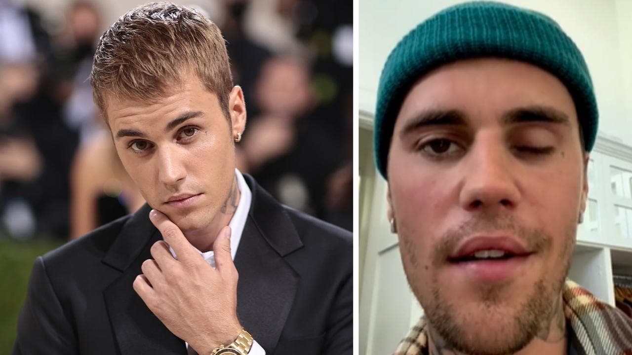¿Qué le está pasando a la cara de Justin Bieber? Un síndrome detuvo su vida por completo