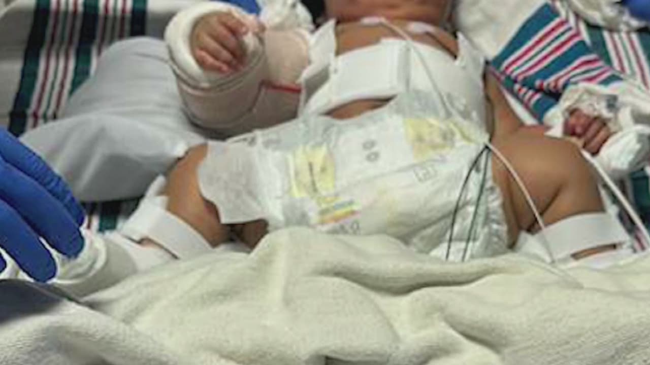 "Está viva por obra de Dios": bebé de dos meses sufre fracturas y quemaduras en caso de crueldad infantil