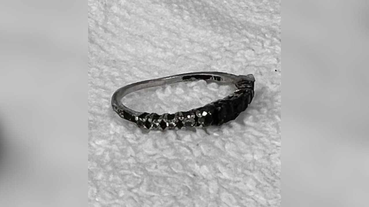 La policía indicó que la víctima tenía un amplio trabajo dental realizado en el pasado, incluyendo tres molares inferiores izquierdos que faltan. También señaló que había un hueco entre sus dientes intermedios delanteros.
<br>