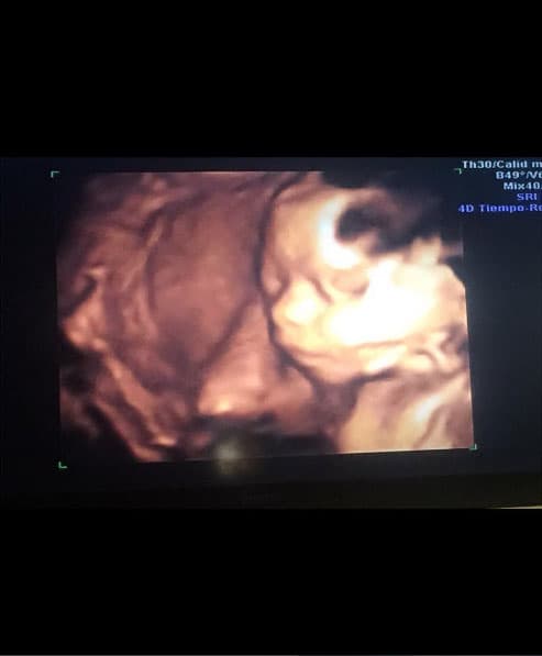 En más de una ocasión mostró el ultrasonido de su bebita: "Mi 2016 💜✨🦄 #teestamosesperando #Lúa #venga2017".