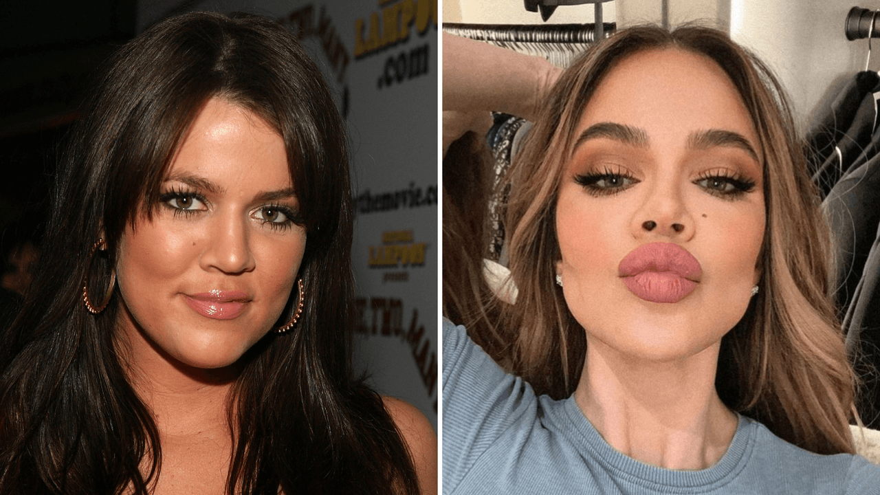 Khloé Kardashian no se queda callada ante quien le pregunta si “extraña su antiguo rostro”