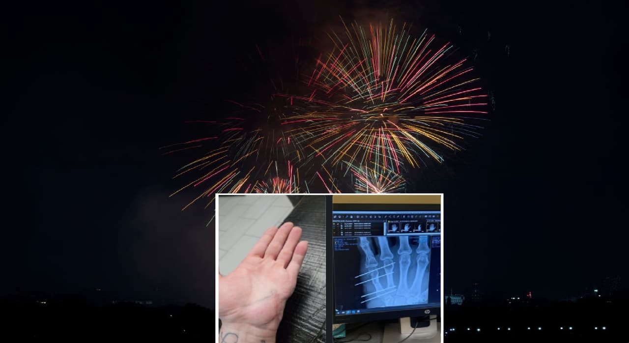 Joven sufre accidente con pirotecnia; "mortero" le estalla en la mano