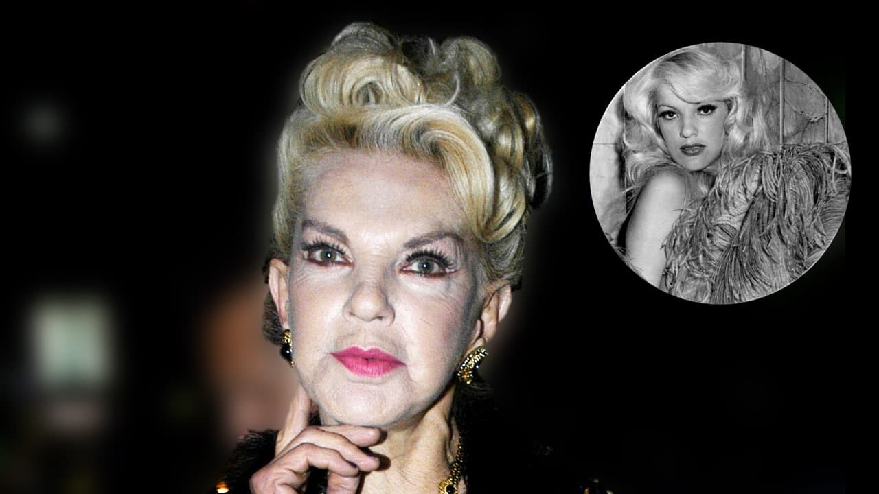 Exvedette Wanda Seux sufre infarto cerebral, su salud es crítica