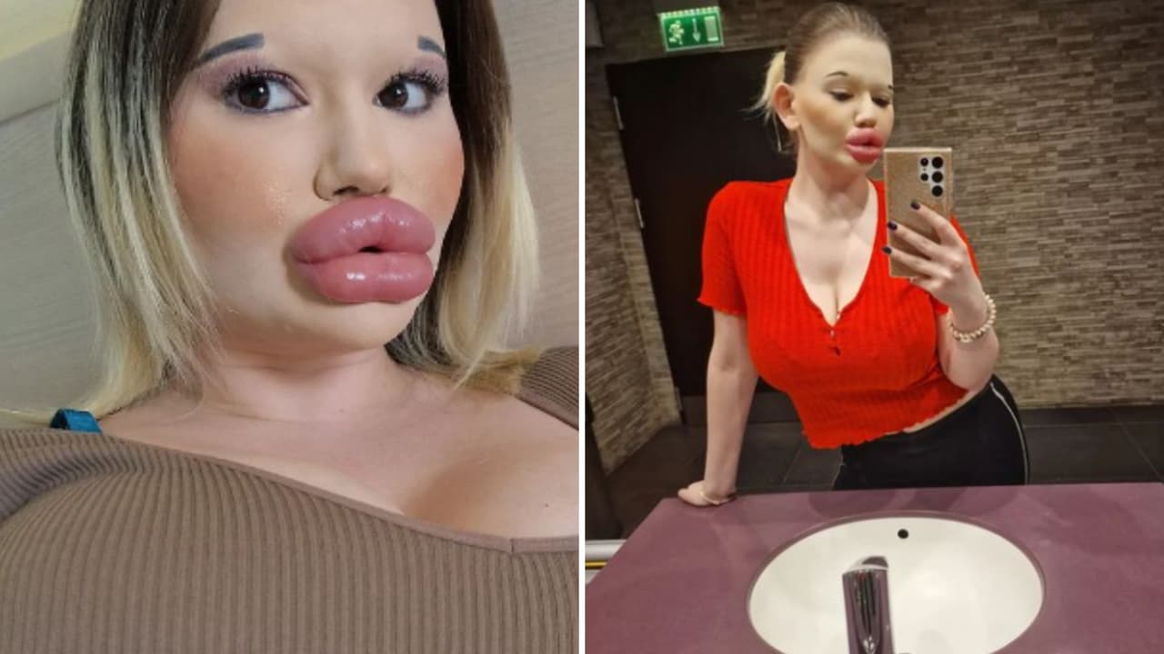 Andrea Ivanova gastó más de 9 mil dólares en procedimientos estéticos