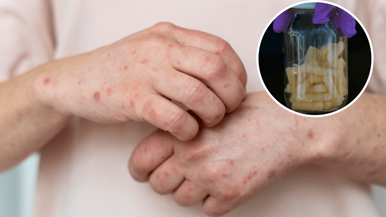 Gusano barrenador en México: estos son los peligros que San Antonio podría enfrentar