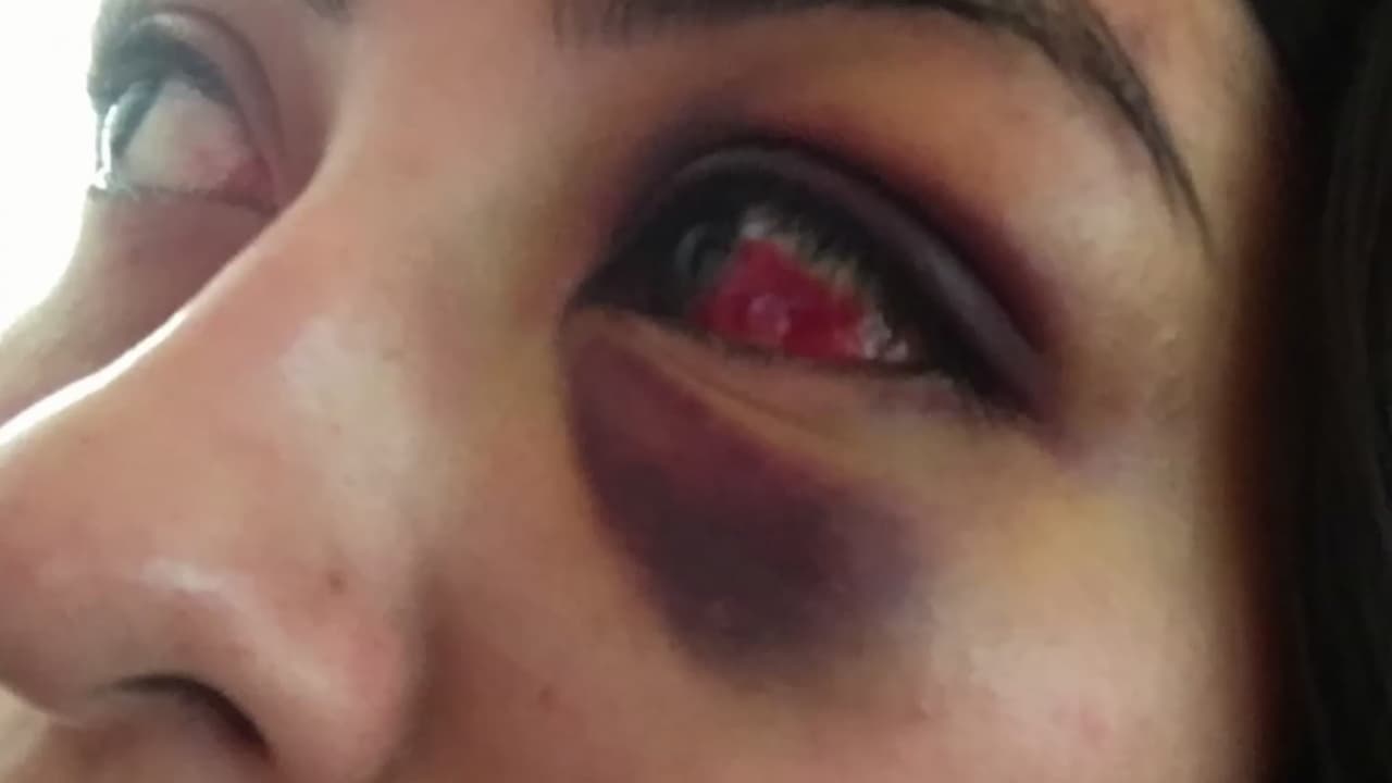 Mujer de Hayward acusa a agentes de abuso policial