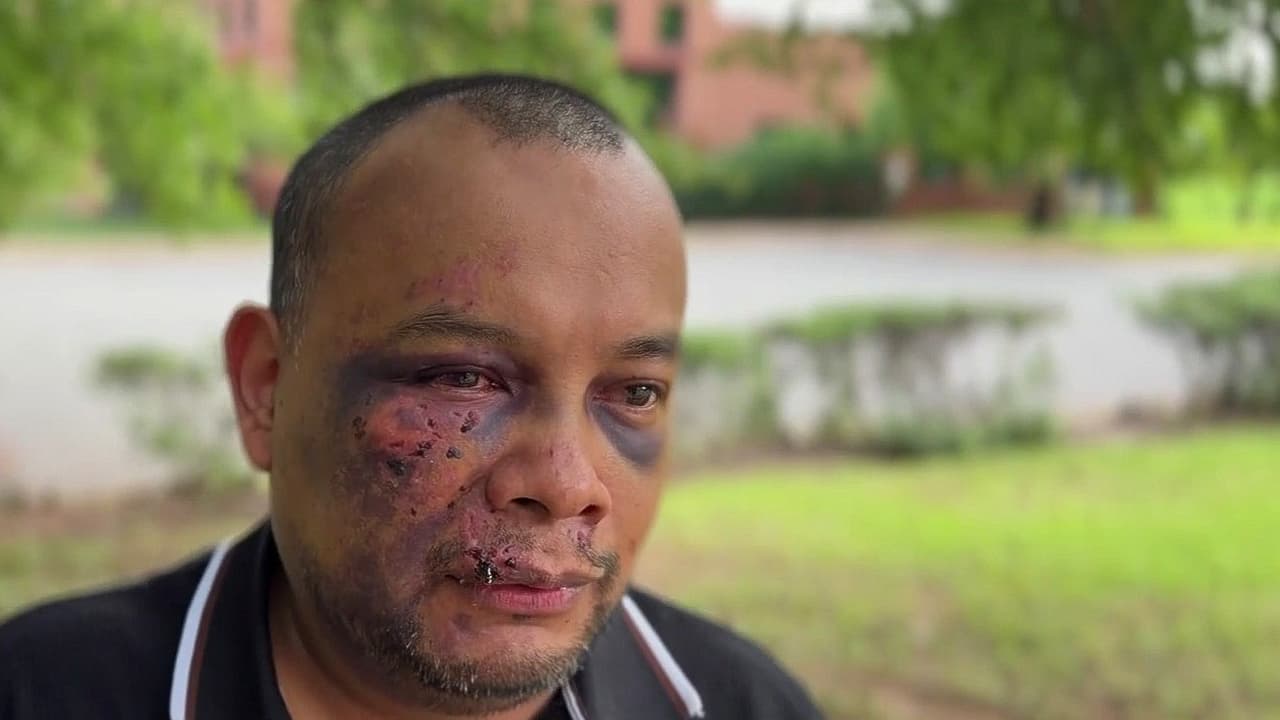 Tras arresto de ICE despertó en el hospital y sin recordar qué le sucedió; entrevista con José Mejía