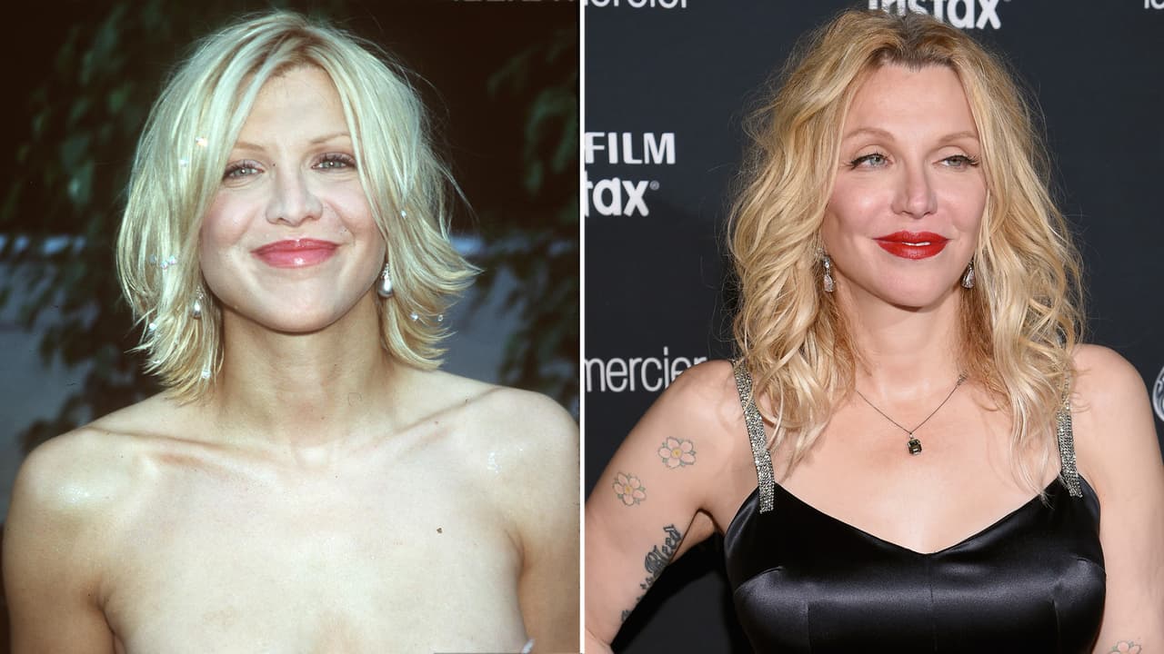 La viuda de Kurt Cobain y vocalista de Hole, Courtney Love, es una prueba de que no siempre es bueno hacerse arreglitos demás. Todo comenzó cuando se operó la nariz, pero luego vinieron los rellenos, la subida de pólumos y paren de contar.