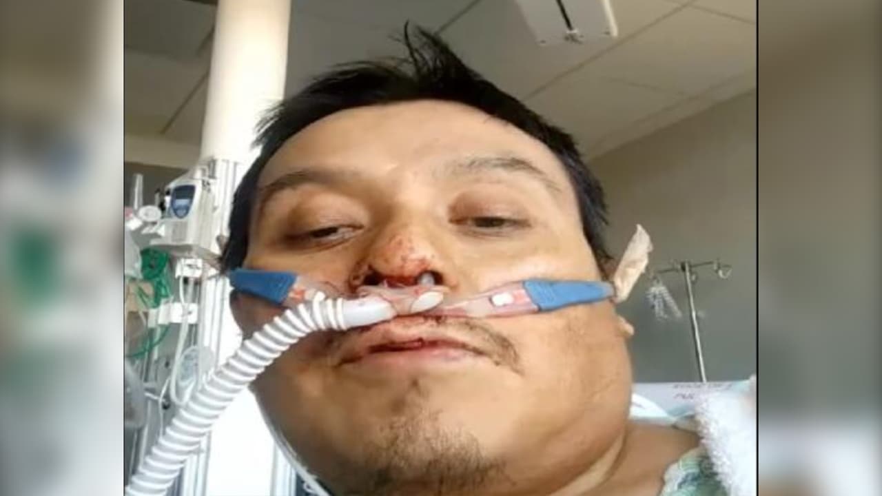 Reportan muerte de Norberto Gutiérrez, mexicano que esperaba trasplante de pulmón