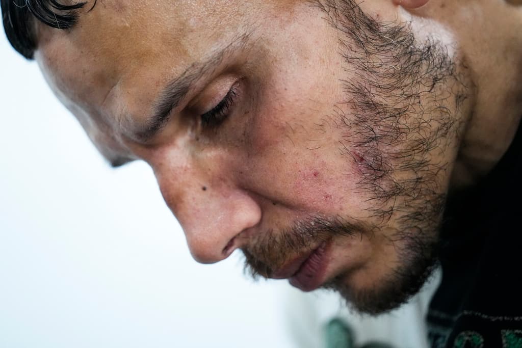 <b>La xilazina o 'tranq',</b> un poderoso sedante animal que se está moviendo a través del suministro de drogas ilícitas, está complicando la respuesta de EE. UU. a la crisis de los opioides, causando horribles heridas en la piel y complicando los métodos tradicionales para tratar la adicción y revertir las sobredosis. 
<b>Dominic Rodríguez</b> habla con la enfermera Kathy Lalli después de que ella tratara sus lesiones en la piel en la camioneta de cuidado de heridas del Hospital Kensington.