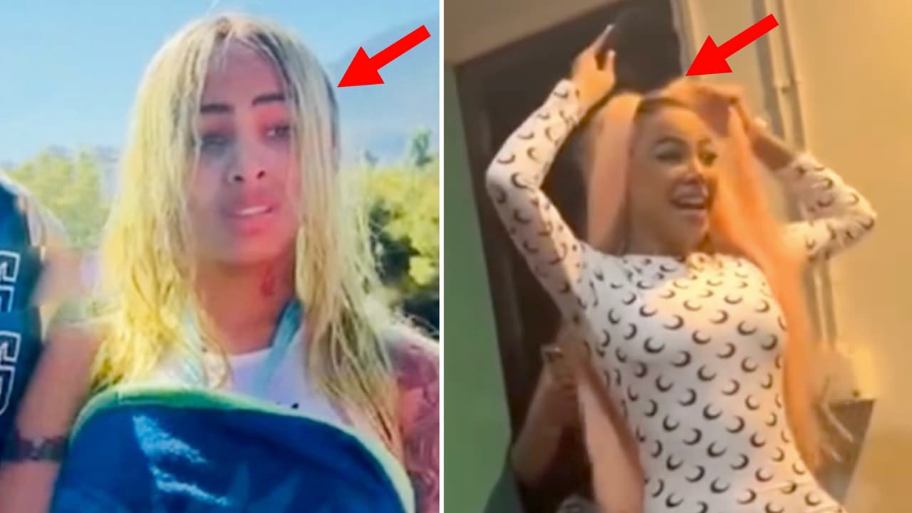 A Yailin se le despegó la peluca en balneario: así han sido sus accidentes