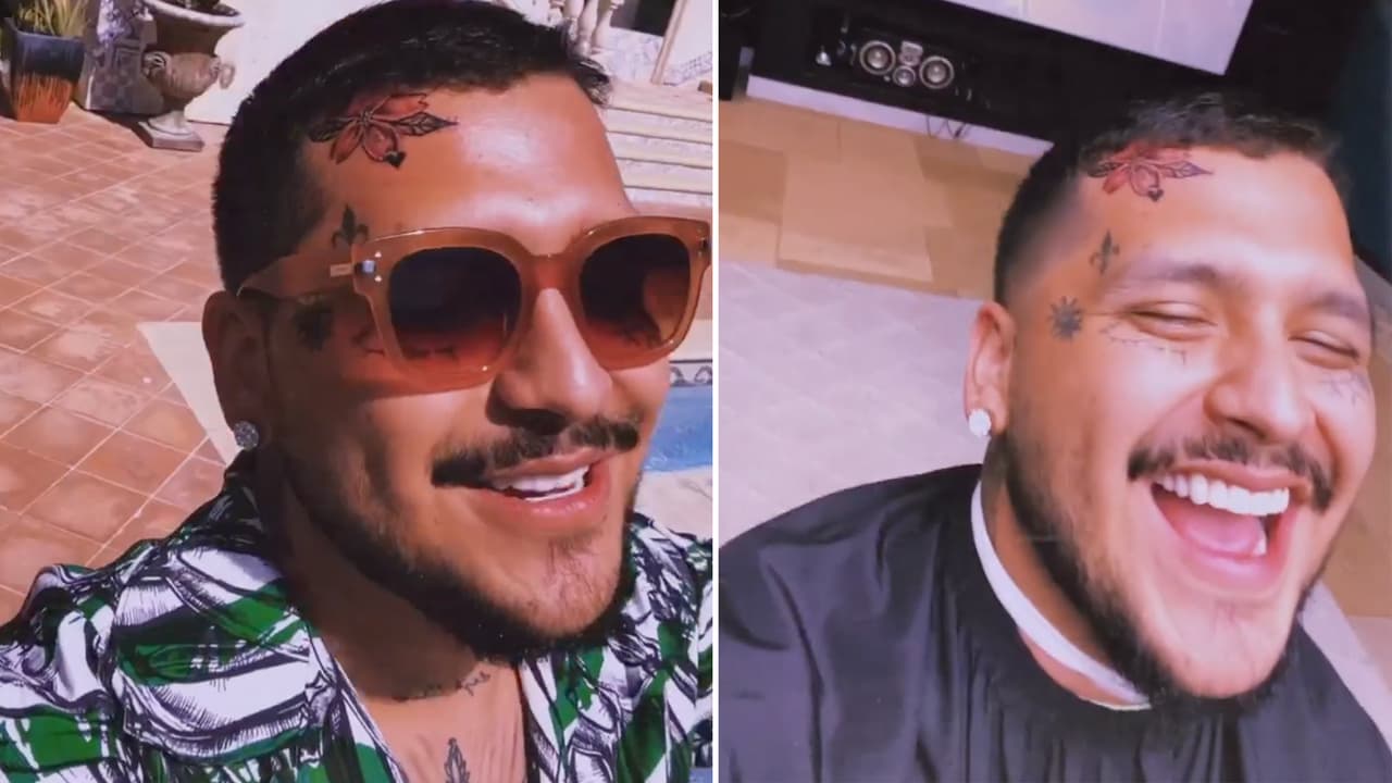 En redes sociales se dio a conocer una foto que podría dejar en claro que algo sucedió en el rostro del cantante de 23 años y ha avivado el debate.
<br>