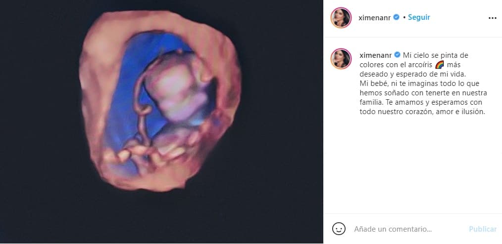 La también actriz mexicana aprovechó para difundir con los internautas que el mito sobre los tratamientos de fertilidad deben de terminar: "Es como cualquier otro tratamiento, para eso existen".