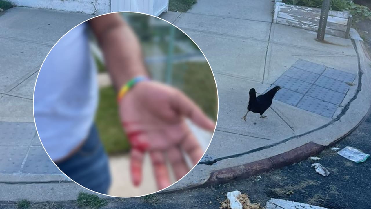 Gallos atacan a residentes de Queens y les dejan varias heridas en sus manos