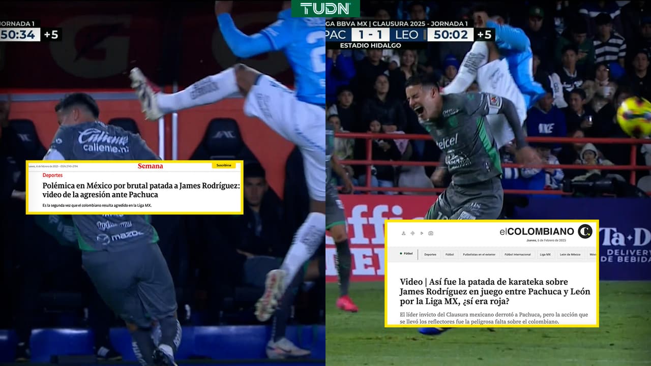 De “criminal” y “brutal” califican en Colombia la patada a James Rodríguez