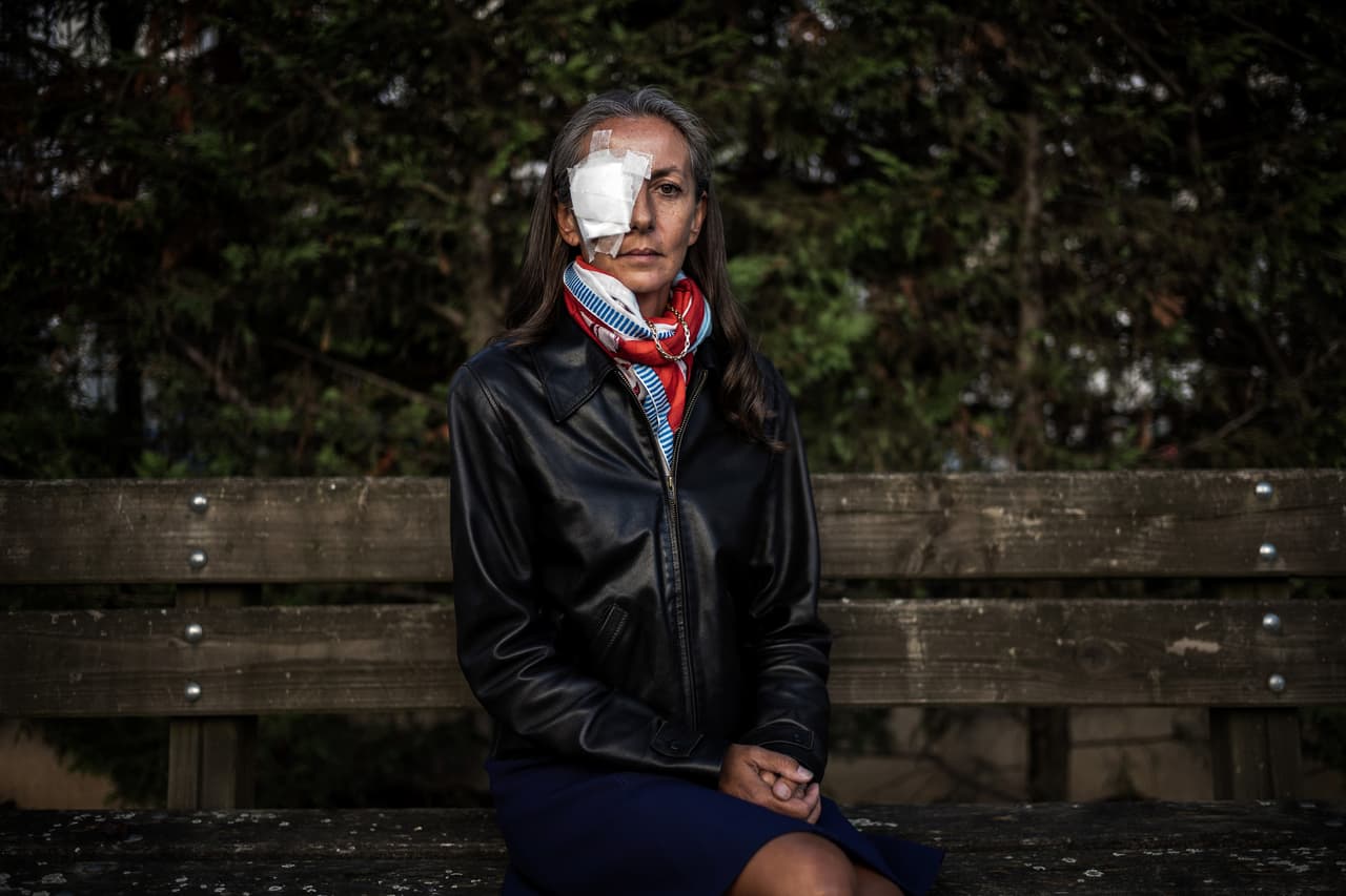 Viajó 2,000 millas para ir a un torneo de golf; una pelota le golpeó el ojo y ya no volverá a ver más