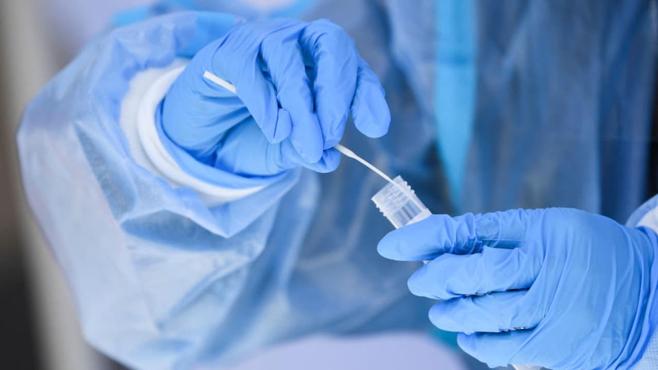 Coronavirus: Las razones por las que la variante de ómicron BA.5 causa tanta preocupación en Los Ángeles