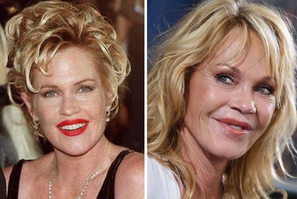 Sí que diste un cambiazo.