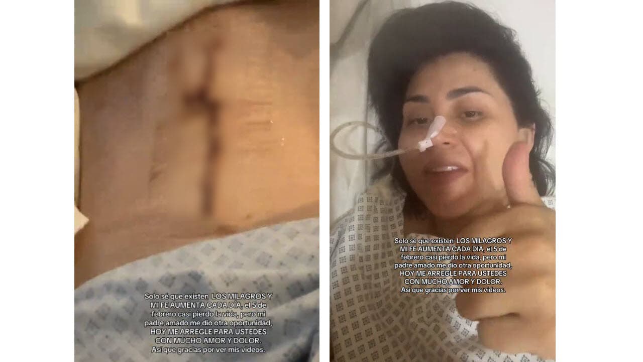 Gomita mostró la cirugía en la parte lateral de su abdomen.