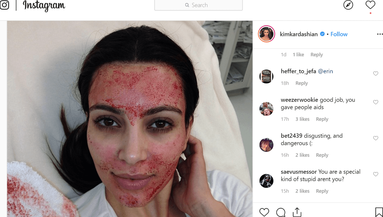 <b>Kim Kardashian los hizo famosos</b>. El boom de los ’faciales vampiro’ se remonta a 2013 cuando la estrella mostró una foto de su rostro bañado en sangre para promover un episodio de 
<i>Kourtney & Kim Take Miami</i> en el que se sometía a este tratamiento. Sin embargo, Kim luego admitió que no le quedaron ganas de repetirlo. 
<b>“Fue una de las cosas más dolorosas que he vivido. No me lo haría de nuevo, aunque sé que tiene muchos beneficios para la piel”</b>, escribió tiempo después en su web.