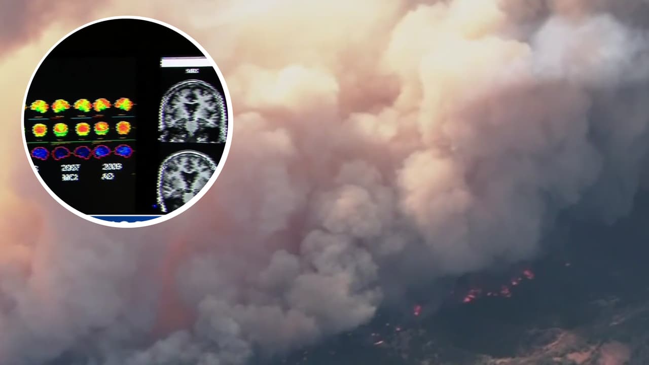 Incendios forestales en California: Humo causa daños al cerebro, revela estudio