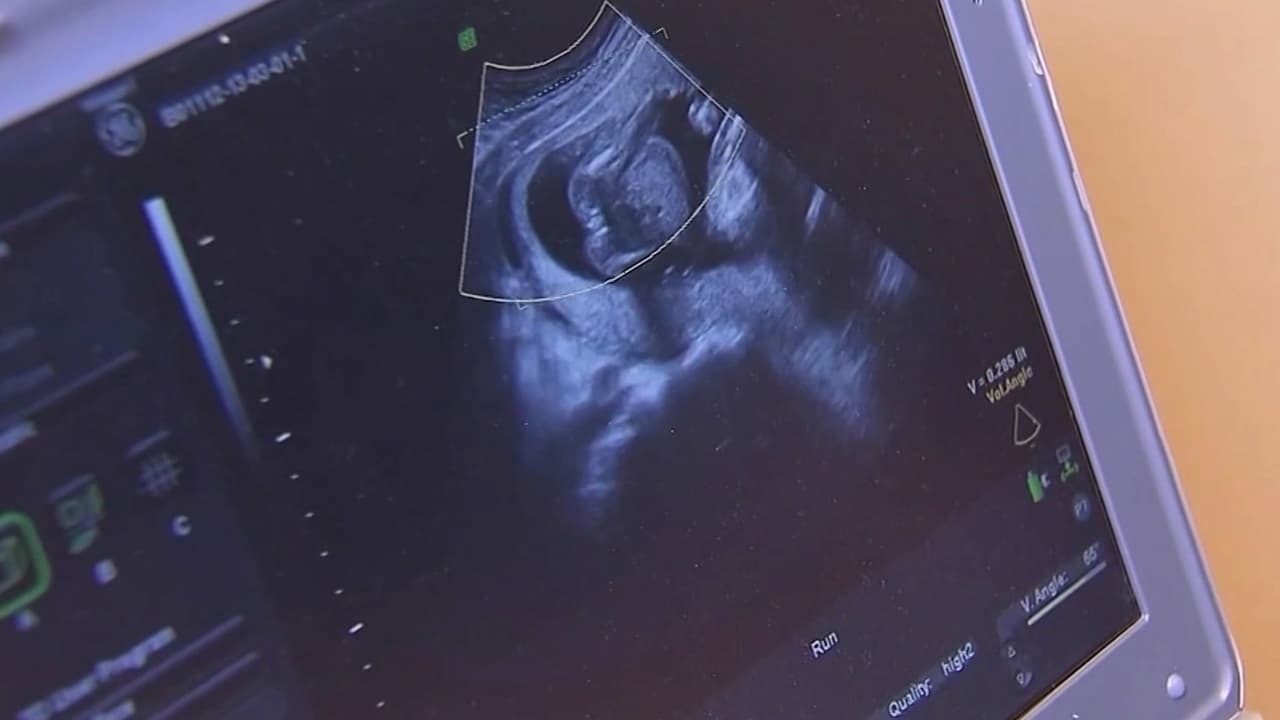 Dilema legal: El caso de un recién nacido en el centro de una disputa entre una pareja y una madre subrogada