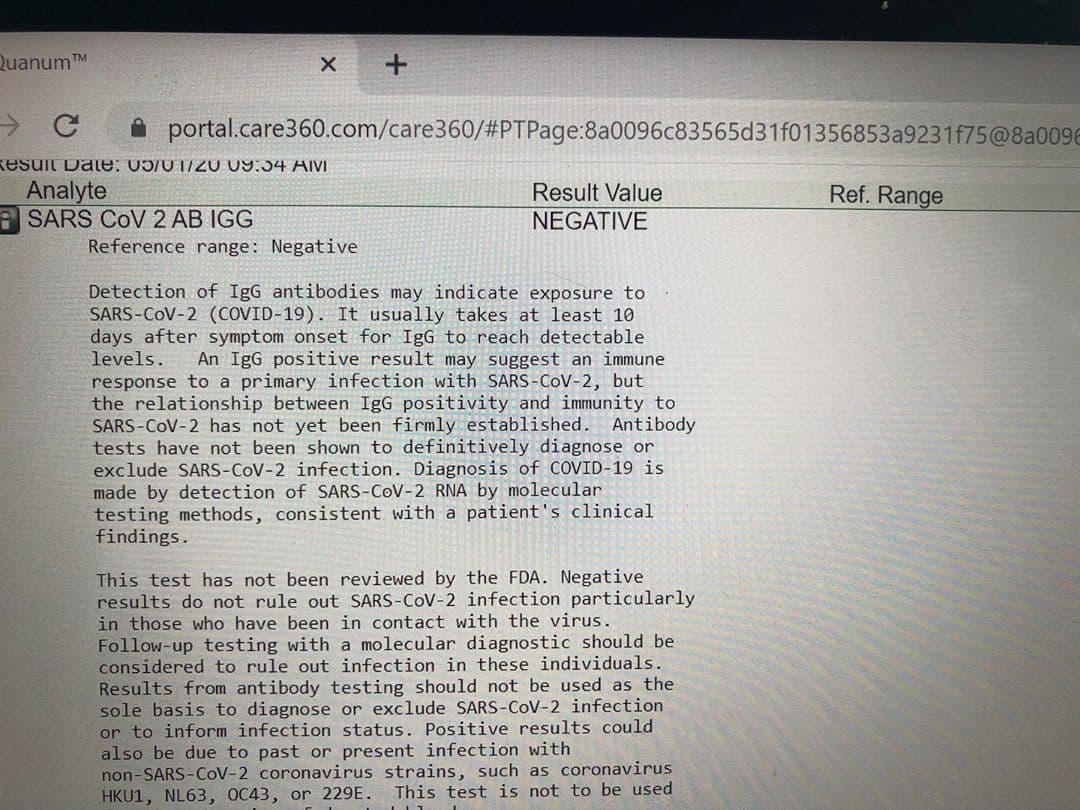 El resultado de un test indica que la persona que se lo realizó no ha estado expuesta al coronavirus. Y quien se lo hizo fue ni más ni menos que Dr. Juan.