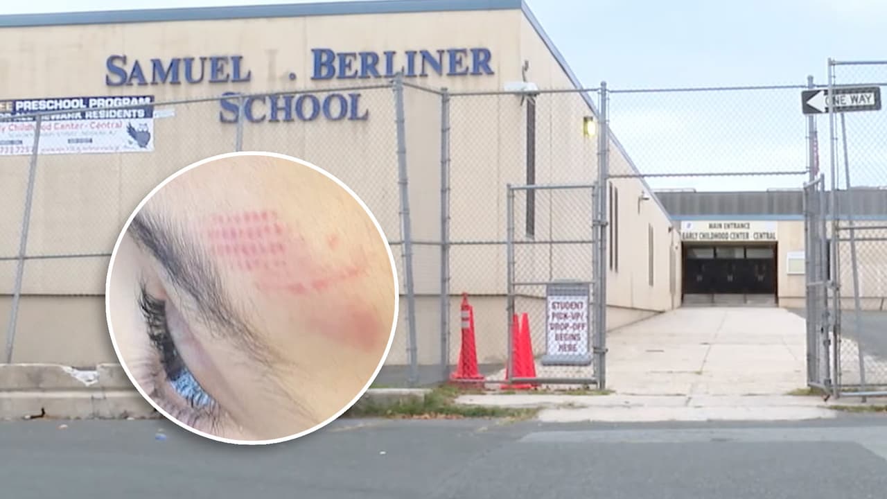 Madre denuncia que su hijo autista de 3 años regresó con lesiones de escuela de Newark