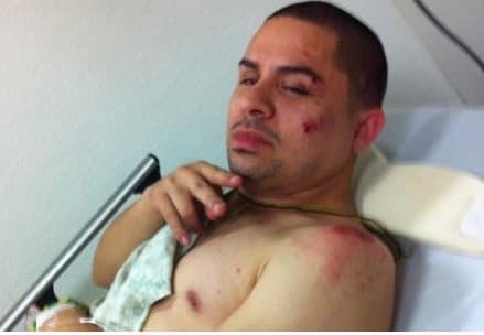 Las veces que se ha accidentado, a pesar de la situación, no deja de subir imágenes, a pesar del estado en el que se encuentre.