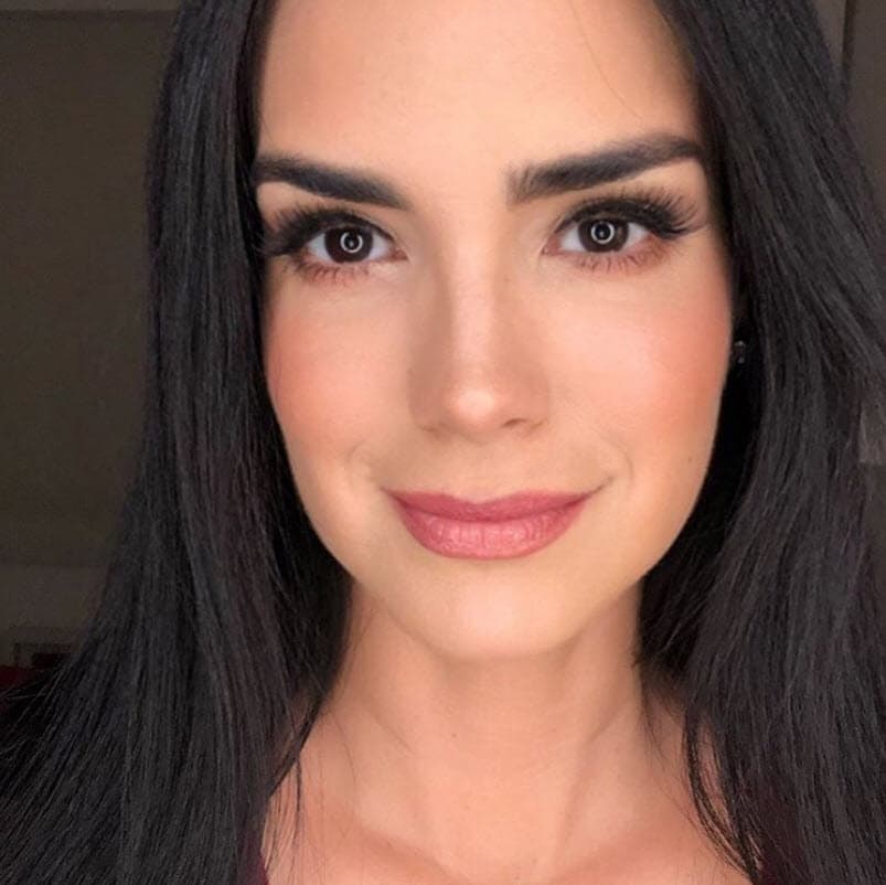 Recientemente Scarlet Ortiz ya había hablado de las cirugías estéticas.