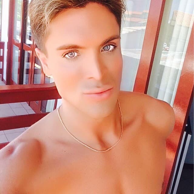 Su transformación comenzó a los 17 años cuando se operó la nariz a escondidas de sus padres.