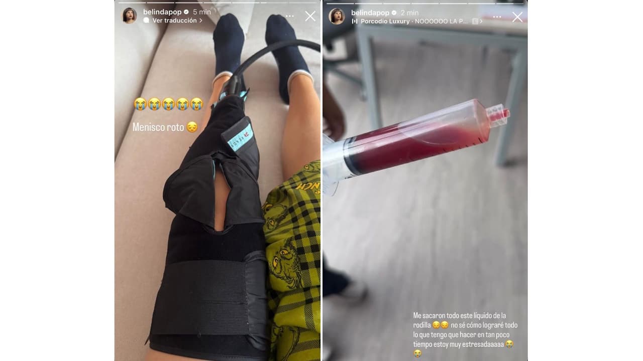 Belinda sufrió un desgarre del fibrocartílago de la rodilla, informó en Instagram.