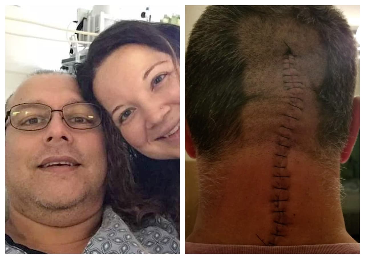 “Hablé con Dios”: Un mexicano asegura estar vivo de milagro tras sufrir dos aneurismas cerebrales