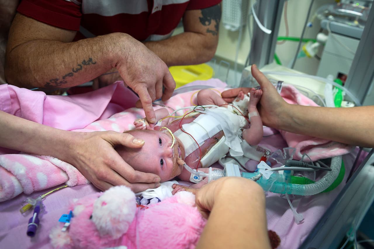 Three-week-old Vanellope Hope Wilkins who was born with an extremely rare condition in which the heart grows on the outside of the body, at Glenfield Hospital in Leicester, Monday Dec. 11, 2017. (Ben Birchall/PA via AP)
