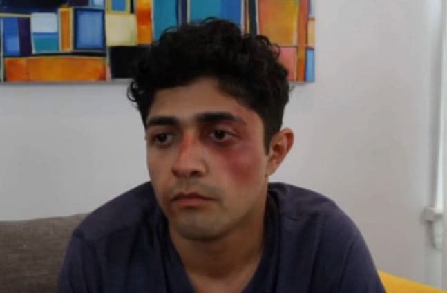 La campaña a favor de la tolerancia donde los insultos sacan moretones