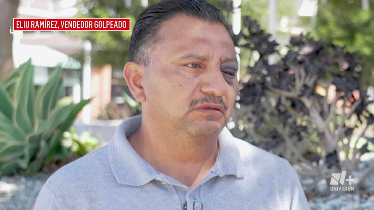 Vendedor hispano denuncia que fue golpeado en playa de Long Beach el 4 de julio: "Esto viene de parte del patrón"