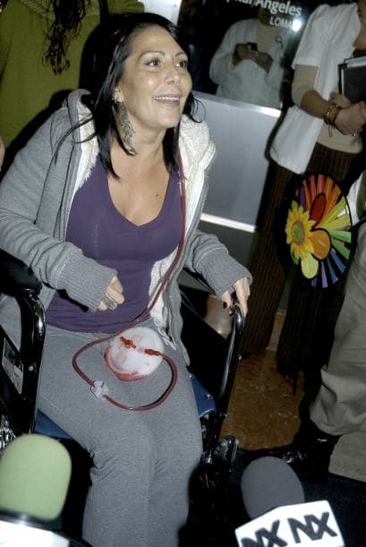 Lo que la llevó a que en el 2012 permaneciera hospitalizada por 30 días, pues se le realizaron diversas cirugías para remediar el daño.