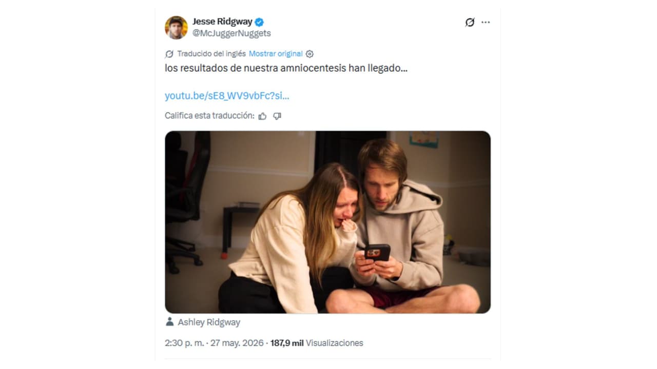 Así se enteraron que su bebé tenía una condición genética.