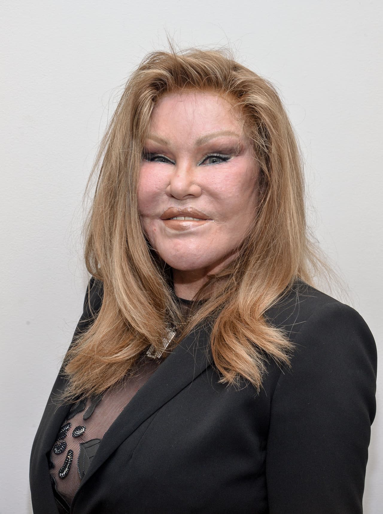 Así luce estos días la socialité Jocelyn Wildenstein. ¡Ay!