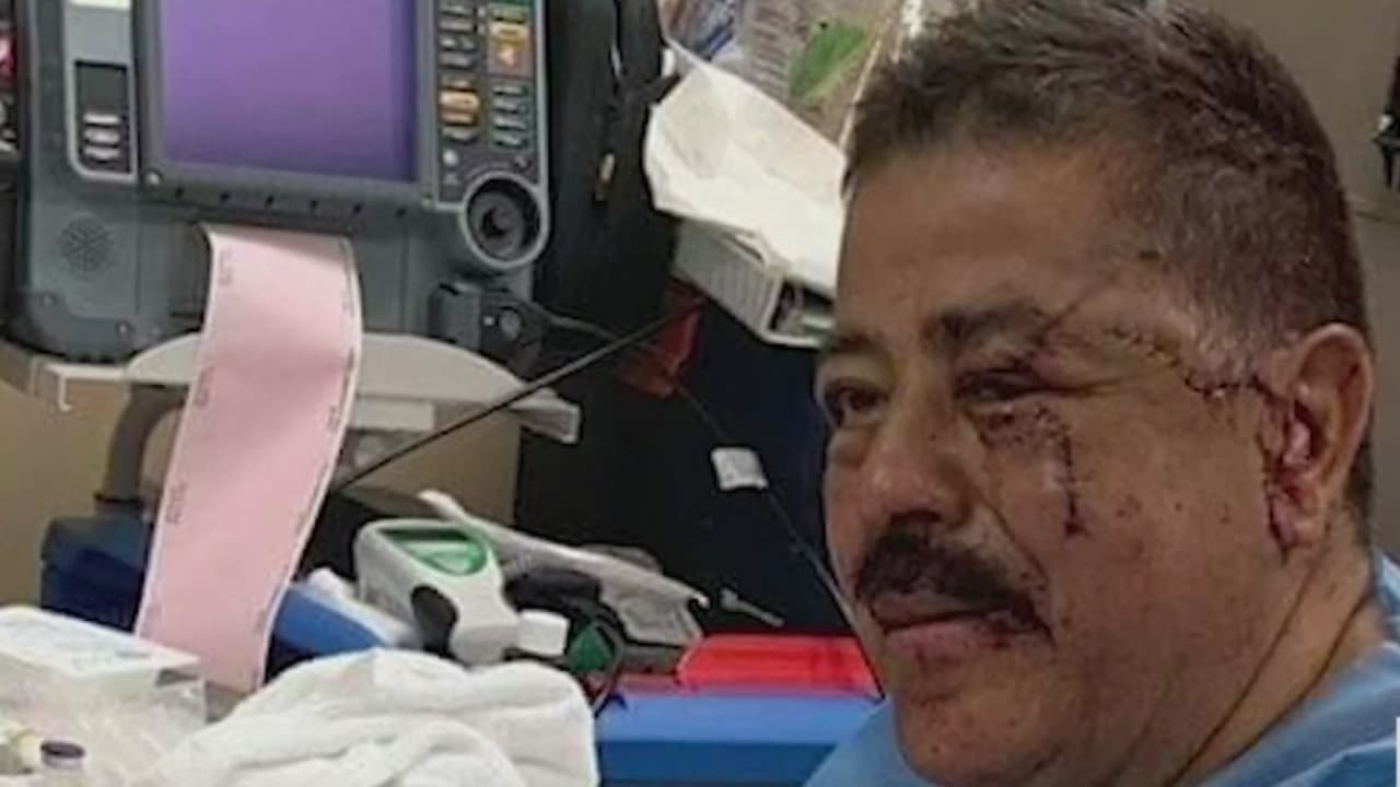 Un pastor casi muere por la ira 'endemoniada' de uno de sus feligreses 