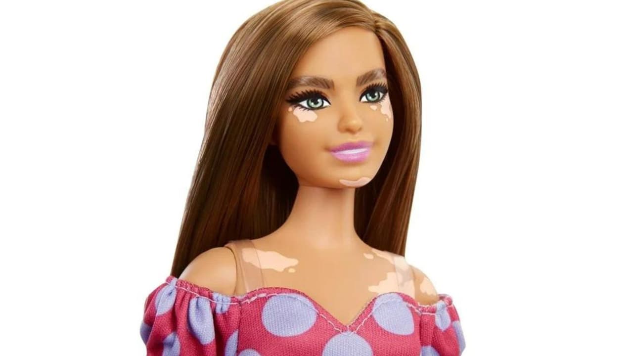 Muñeca con vitiligo