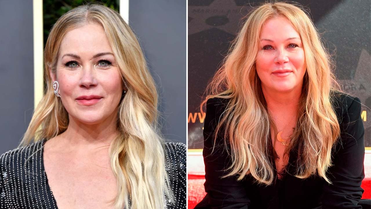 Christina Applegate superó el cáncer, pero ahora tiene otra cruel enfermedad: "Ni siquiera puedo usar zapatos"