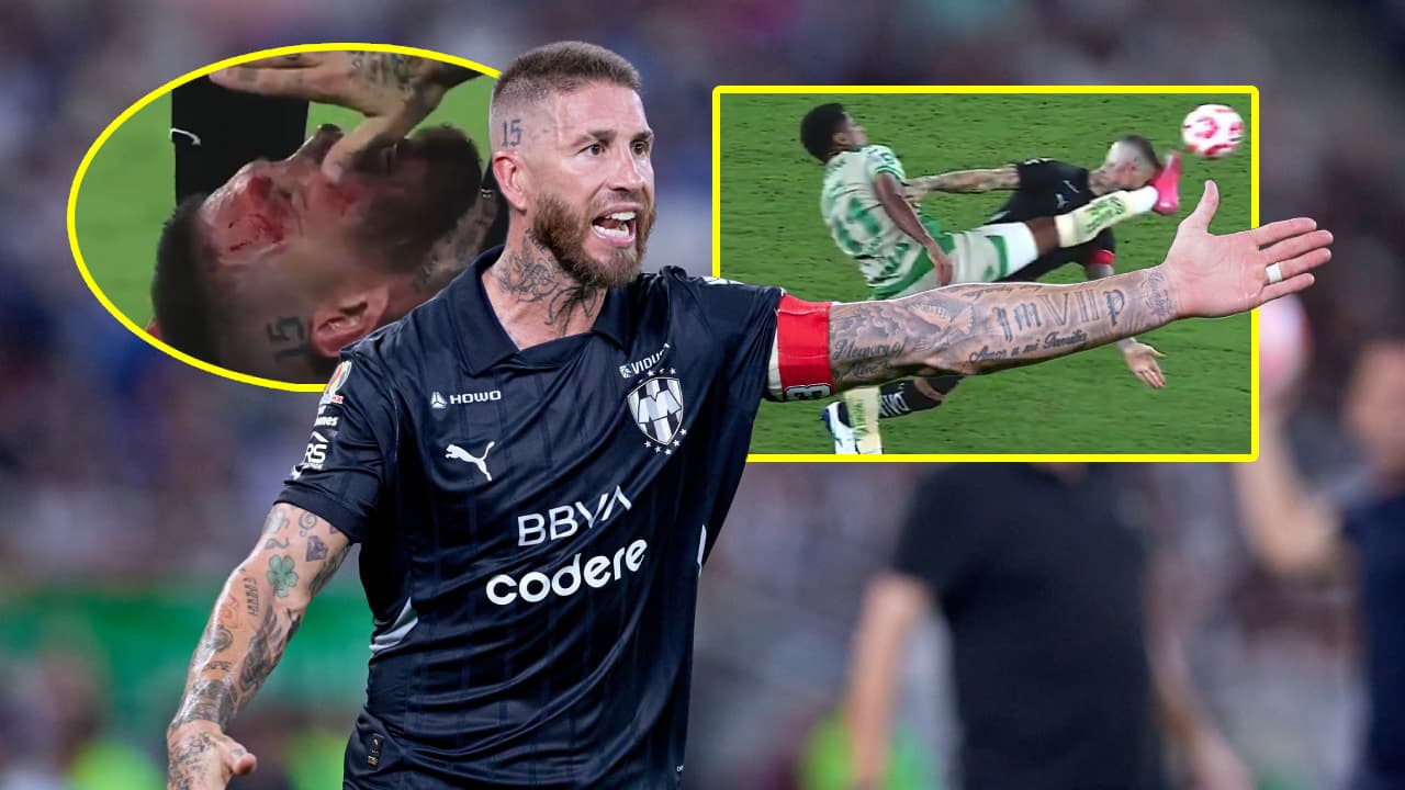 Ramos rompe el silencio tras dura patada que lo dejó ensangrentado