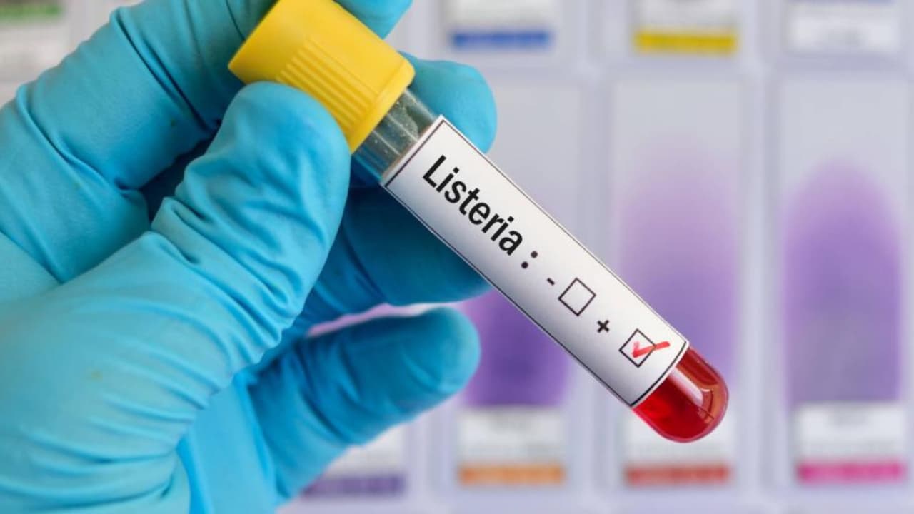 ¿Cuáles son los síntomas de la listeria? Nuevo brote afecta al menos a 10 personas de California y Nevada