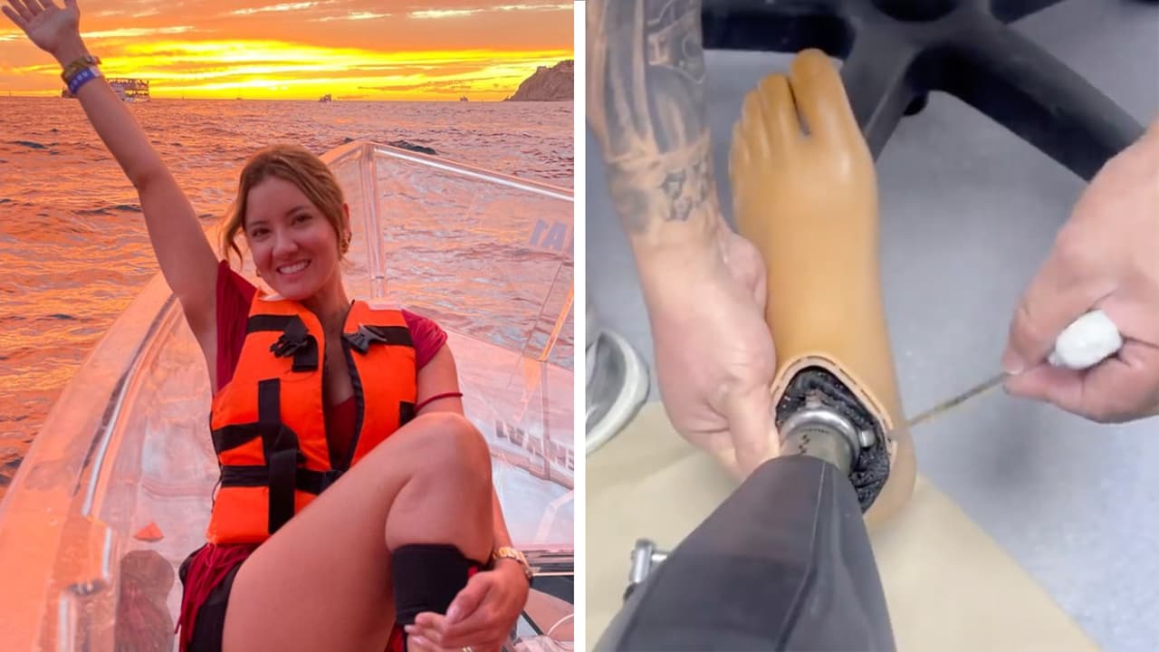 La prótesis de Daniella Álvarez pagó las consecuencias de sus románticas vacaciones en México