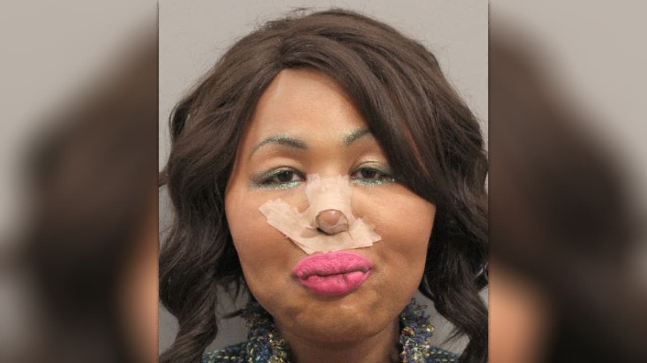 Robaba bancos para hacerse cirugías, pero fue arrestada al volver de México